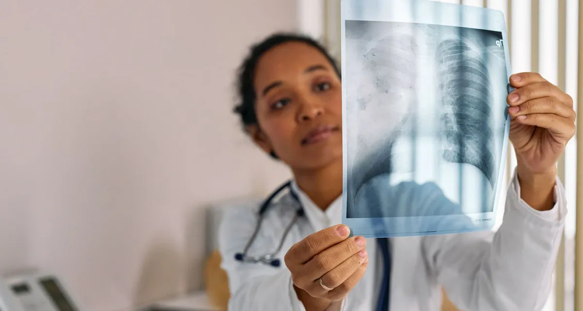 A clinician in a white coat holding a chest x-ray up to the light and studying it
